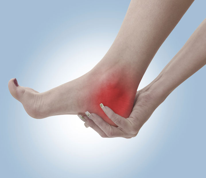 Plantar Fasciitis Chiropractors Turlock