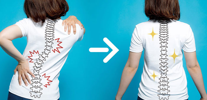 chiropractic for good posture in Turlock CA