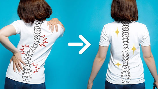 chiropractic for good posture in Turlock CA