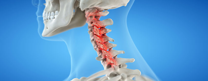 patient needing bone spur treatment in Turlock
