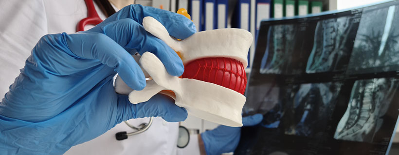 patient needing herniated disc treatment in Turlock