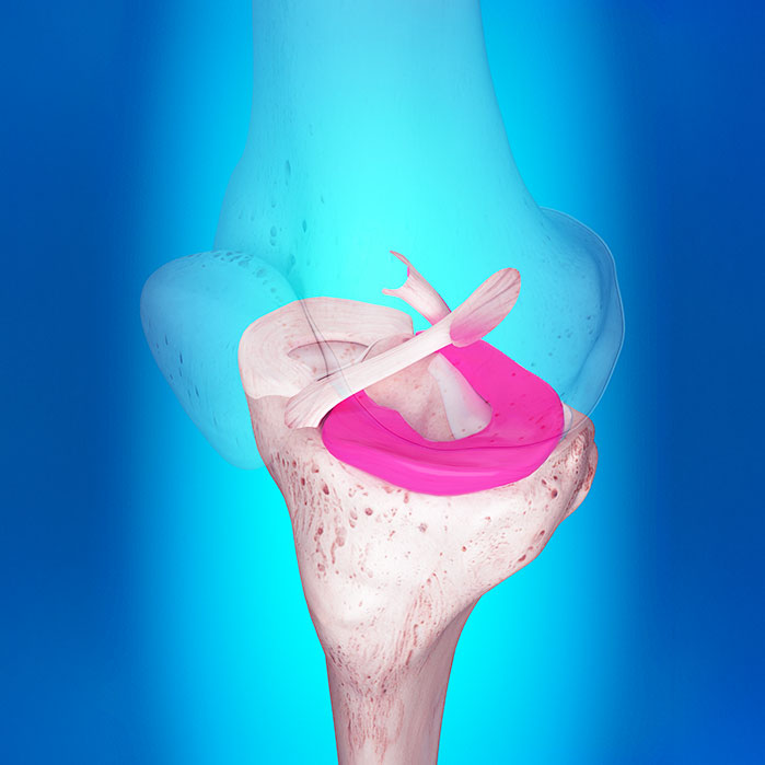ligamentitis chiropractor in Turlock CA