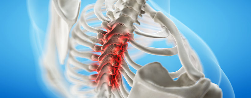 patient needing spinal stenosis treatment in Turlock