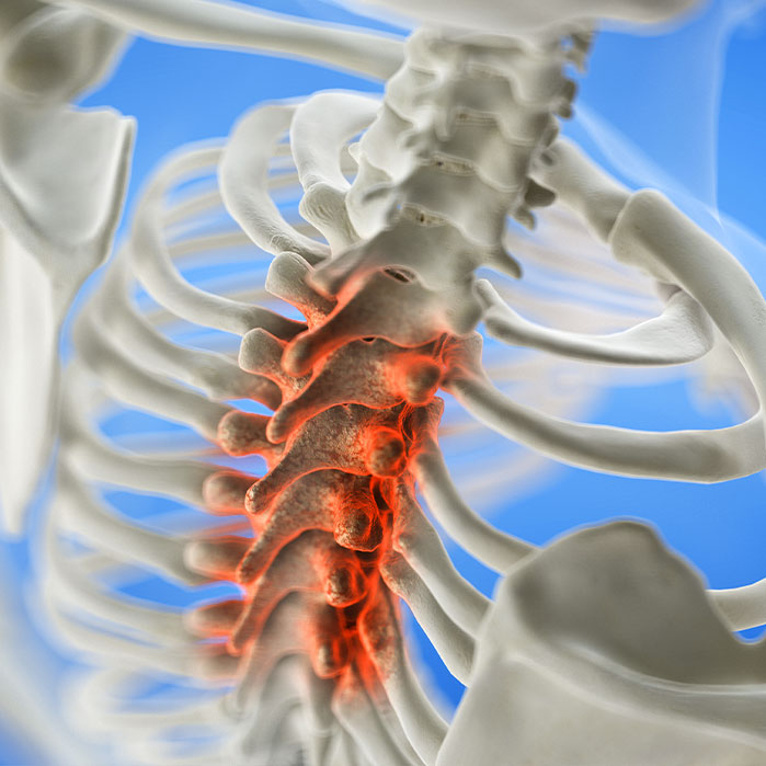 spinal stenosis treatment in Turlock CA
